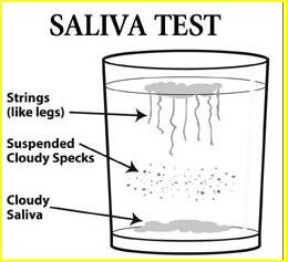 Saliva Candida test Illustration