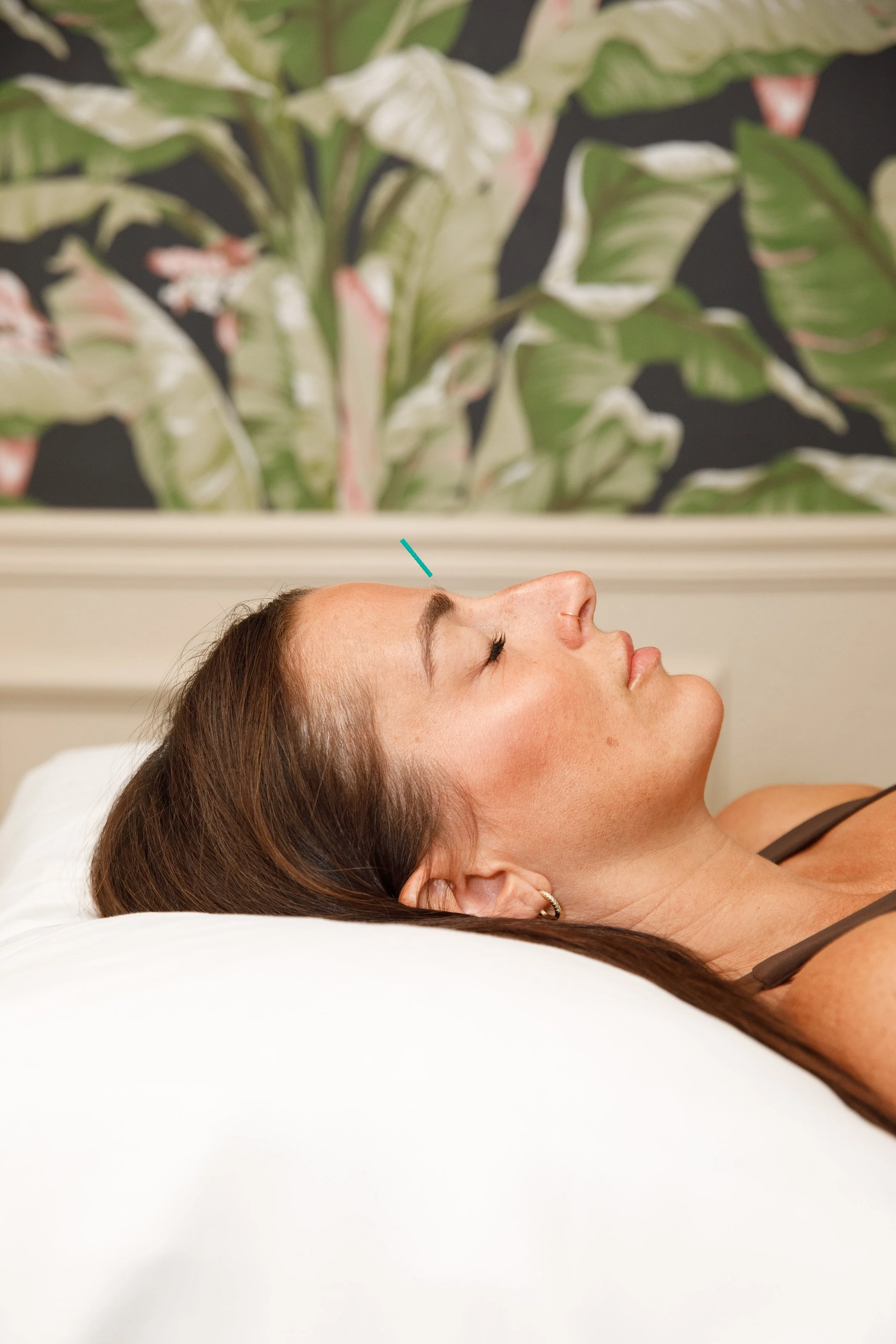 acupuncture san diego