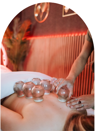 Acupuncture and cupping for pain management in San Diego
