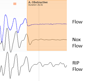 Laboratory Sleep Test — Sleep and Brain