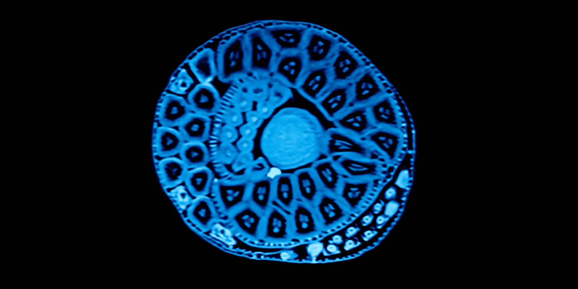 Still image from the film "The Scan" showing an MRI scan image of a human brain