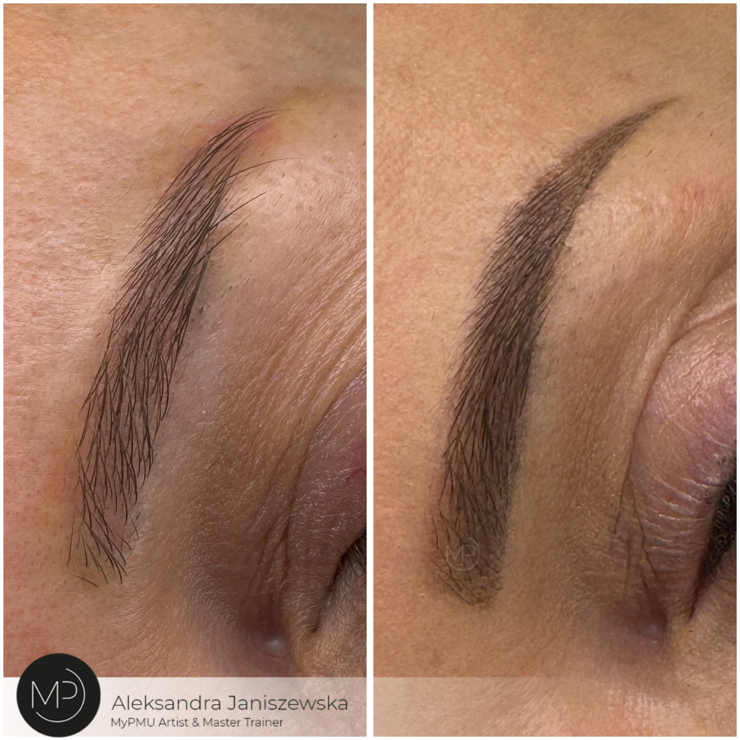 Vorher-Nachher Beispiele bei PMU-Korrekturen in Wien