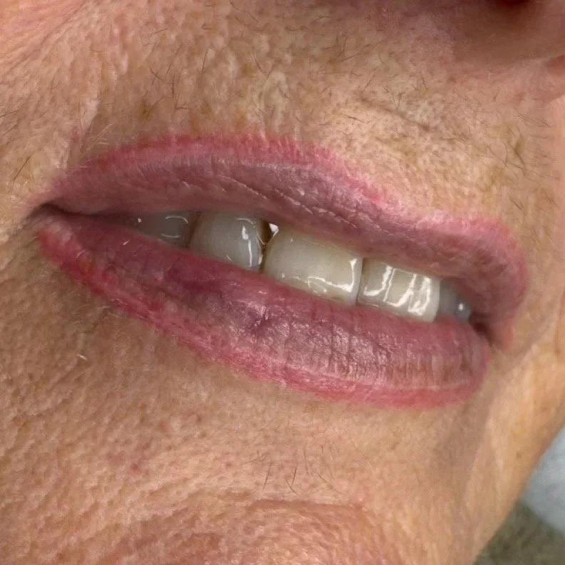Misslungenes Lippen-PMU