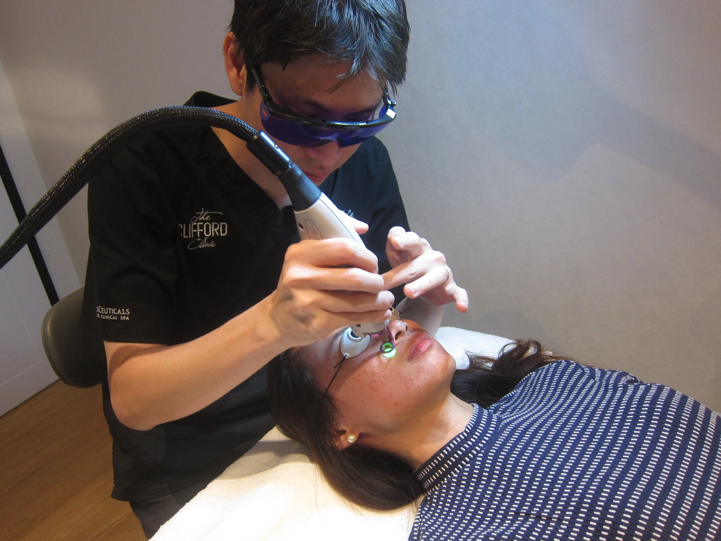 REVIEW: V-BEAM LASER @ THE CLIFFORD CLINIC