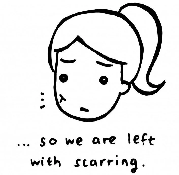 MY BATTLE WITH ACNE. YOU NEED TO READ THIS. (Part I)