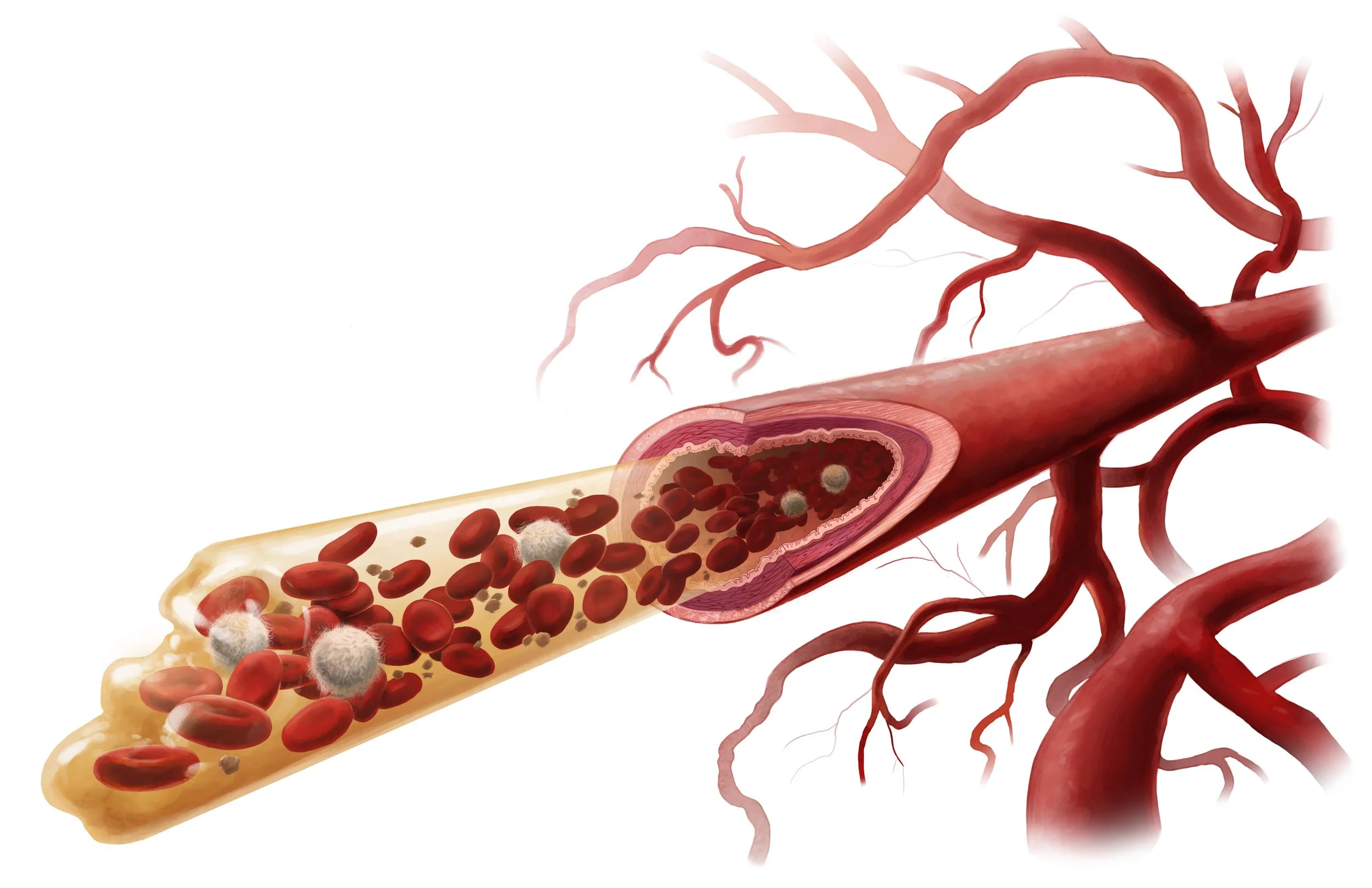 BloodVessels.jpg