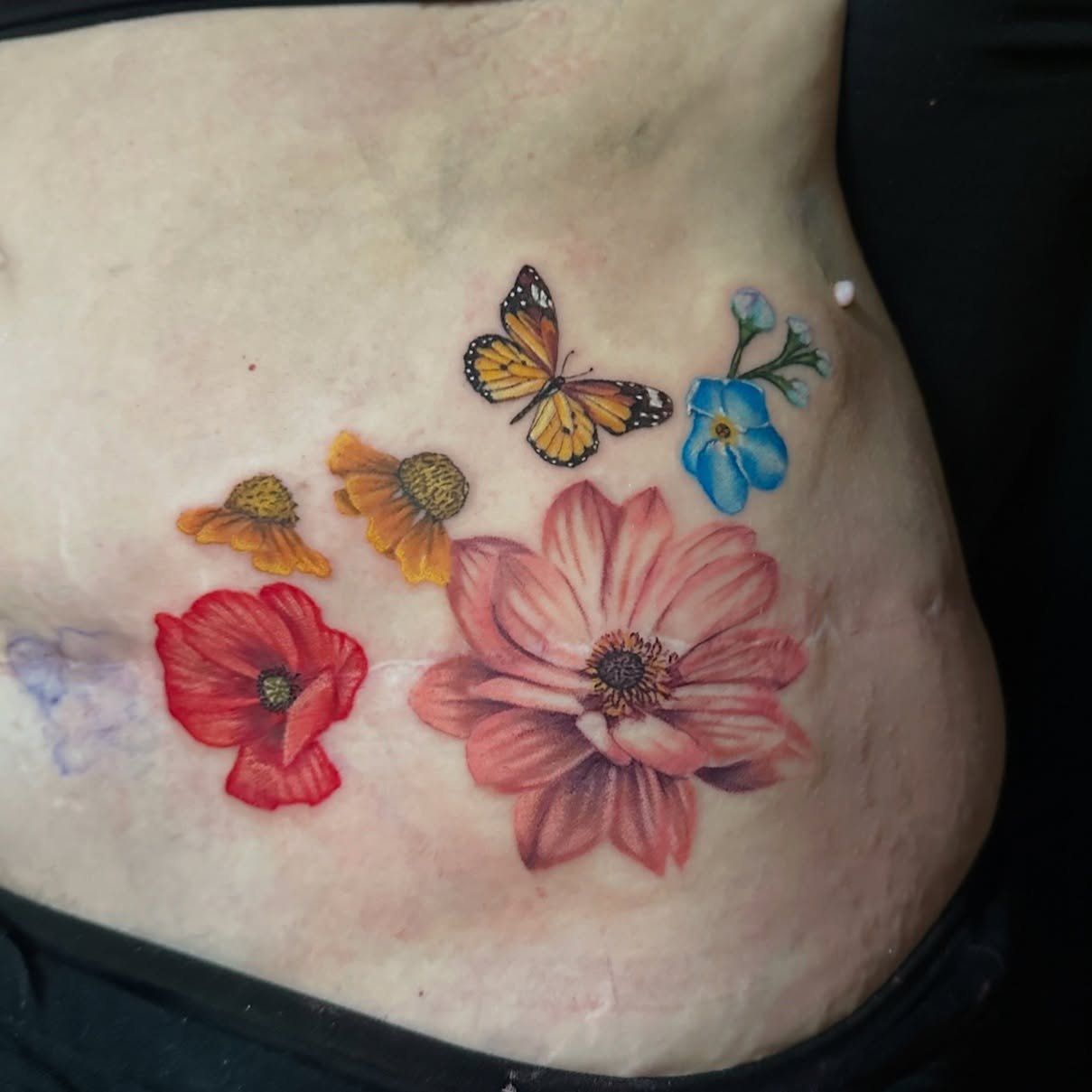 In progress Scar Coverup by the incredible @amandamastattoo 🌸 Scar coverup pieces require sensitivity and a creative, loving vision. Amanda&rsquo;s artistry and kind spirit are perfect for this beautiful piece🤍 We can&rsquo;t wait to see how it tur