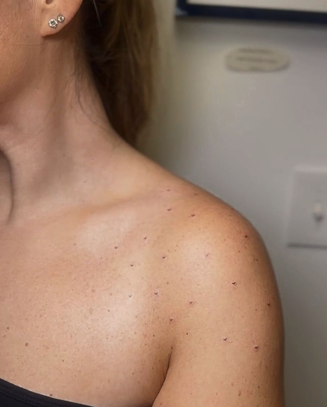 This heart freckle trend is officially our newest obsession 😍

Ready for yours? Book with @beautyxtheink &mdash; link in bio 🤍

#HeartFreckleTattoo #WestportCT #TinyTattoo