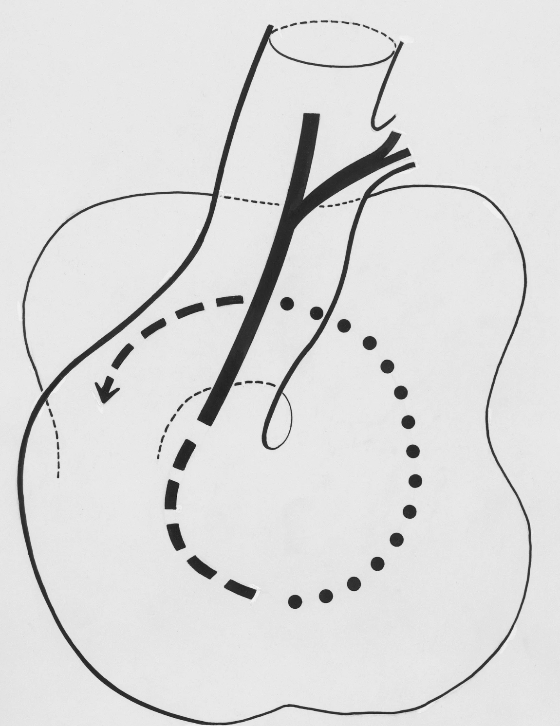 #431 The Great Sprit of Circulation 