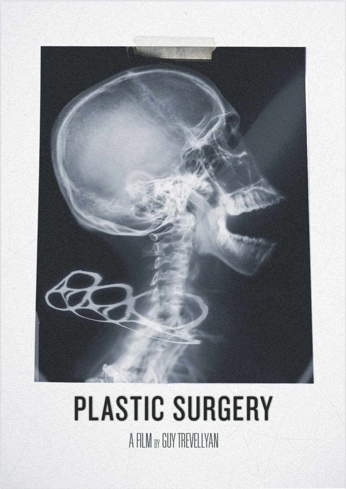 Plastic Surgery - Poster