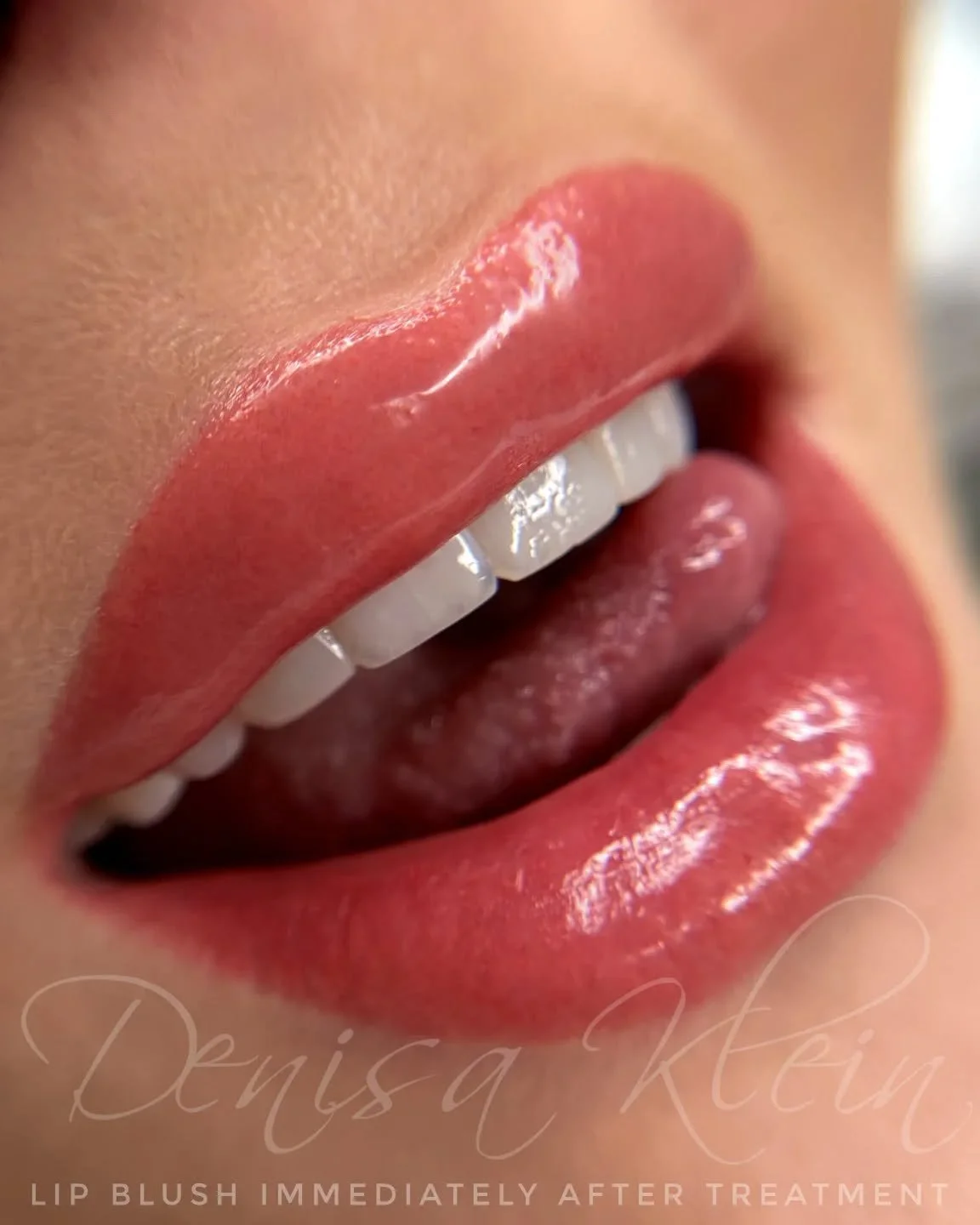 Say hello to effortlessly beautiful lips!
Lip Blush is a semi-permanent treatment that enhances the natural shape and colour of your lips, giving them a fuller, more defined look&mdash;without the need for lipstick. 

Perfect for:
&bull; Pale or unev