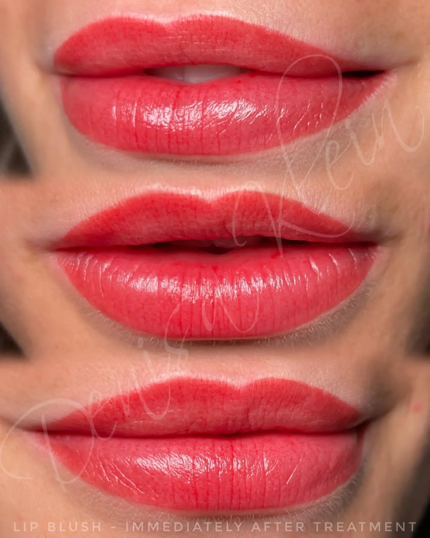 This gorgeous Lip Blush is giving rich, radiant colour with a soft, polished finish 💋
Healed results fade into a beautifully soft tint tailored just for you.

💰 Price: &pound;345 initial treatment 
&nbsp;  Touch up after 6 wek &pound;95
🕑 Time: 3 