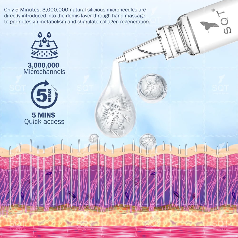 SQT Bio Microneedling DENISA KLEIN BEAUTY sqt-bio-microneedling-denisa-klein-beauty