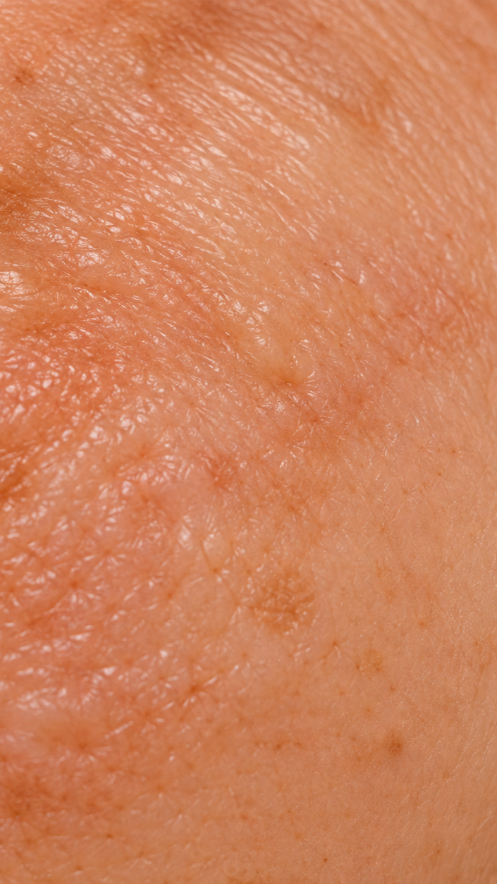 Close-up of human skin showing pores and fine hair