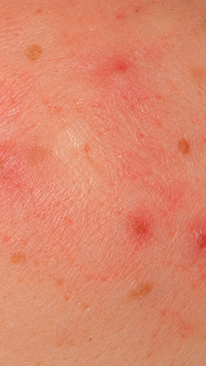 Close-up of human skin showing redness, small bumps, and a few brown spots, indicating irritation or mild skin condition.