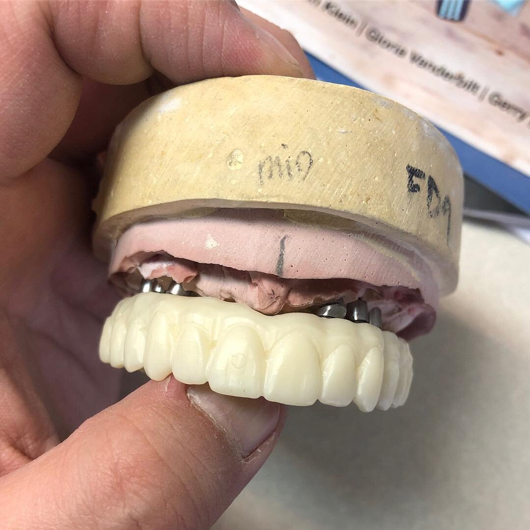 Fresh out of the oven😁👍🏻 #fullmouthrehabilitation #fullmouthreconstruction #fullmouthrehab #dentaldesign #dentaltechnician #dentaltechnology