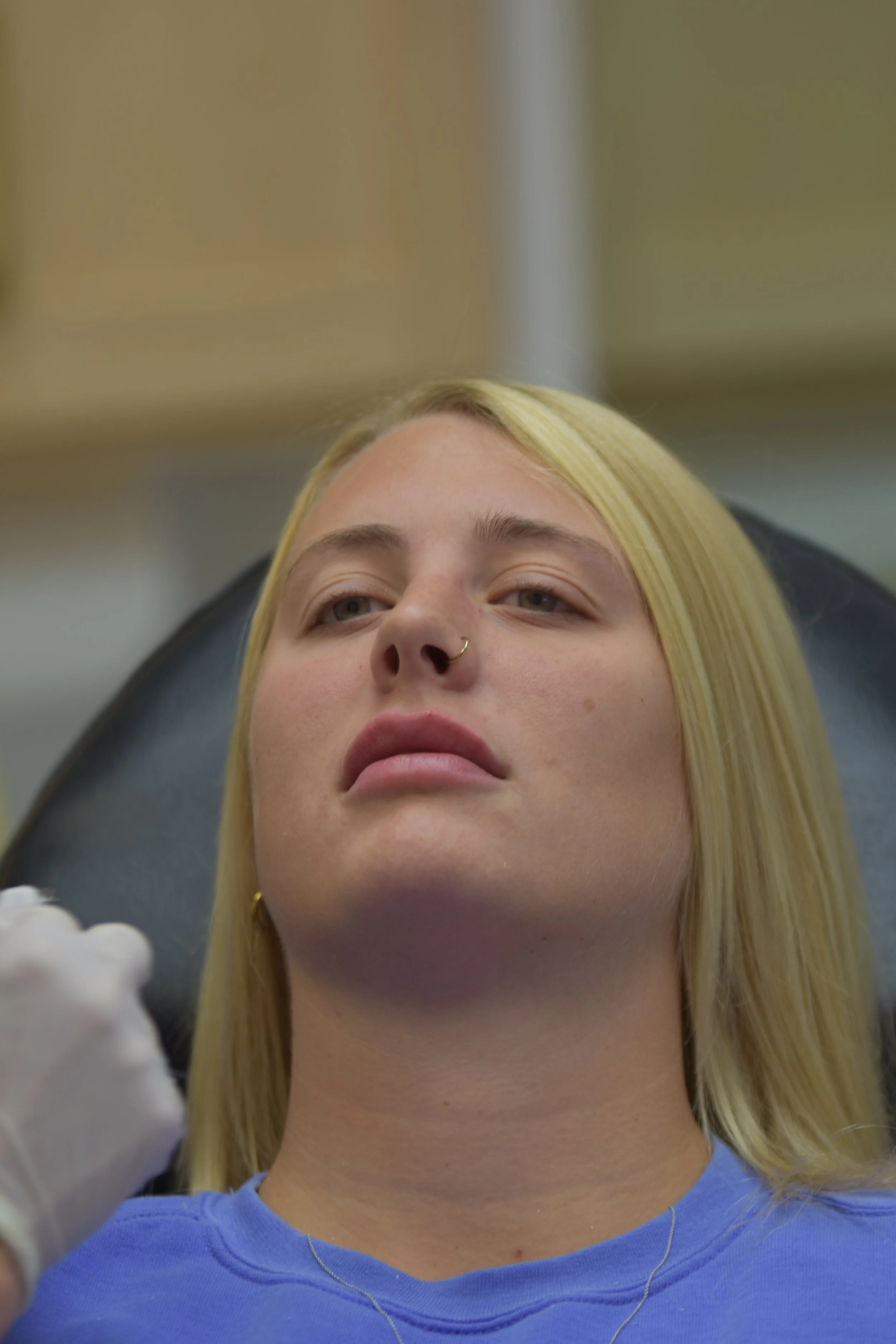 VI Peels — Lace and Needle