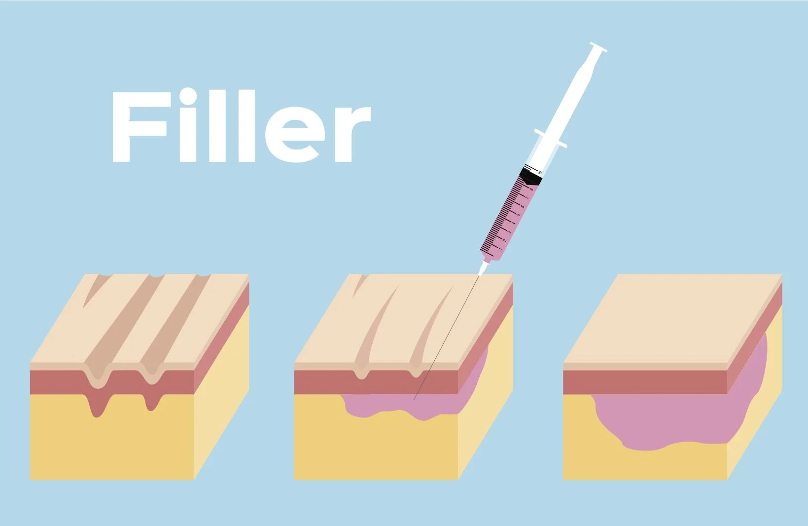 FAQs — Lace and Needle