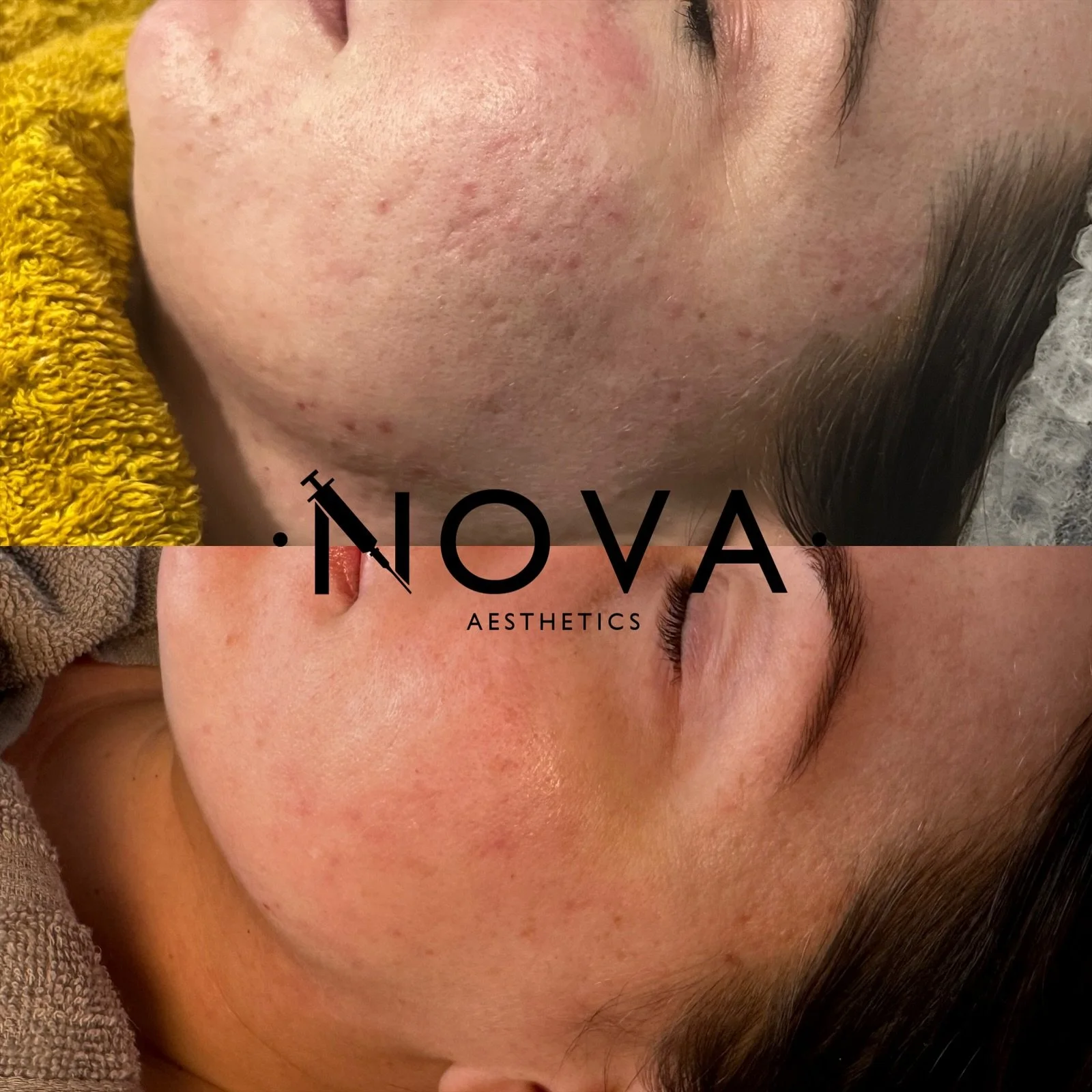 eZy Watermark_24-08-2024_12-47-58-6400PM.JPG