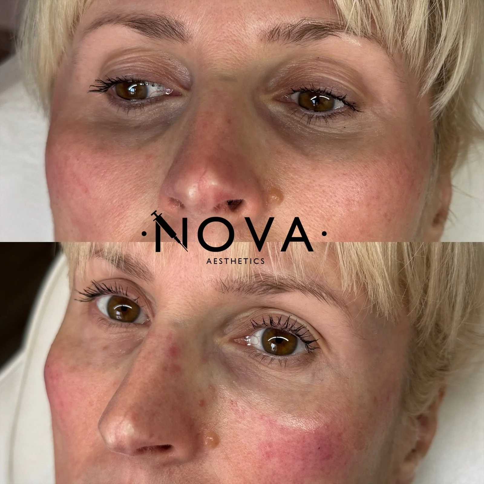 eZy Watermark_10-09-2025_10-10-49-9550pm.JPG