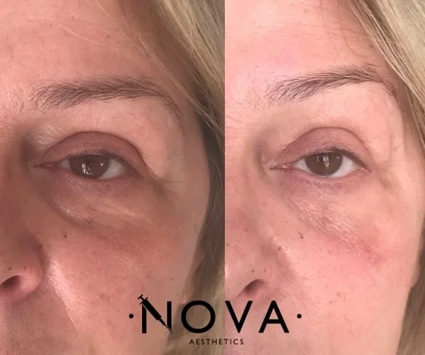 eZy Watermark_21-08-2023_02-10-18-7980pm.JPG