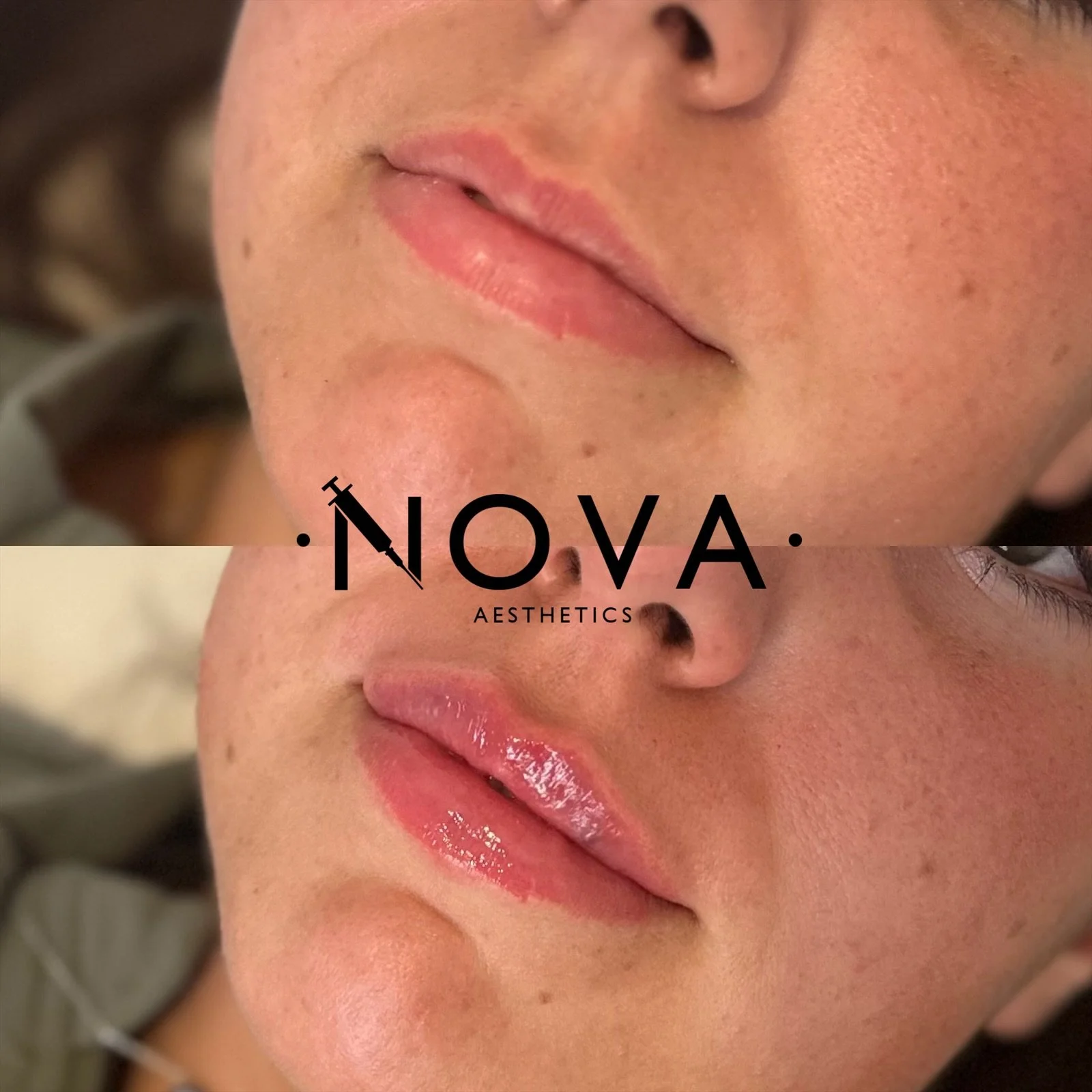 eZy Watermark_18-08-2024_11-51-00-2640PM.JPG