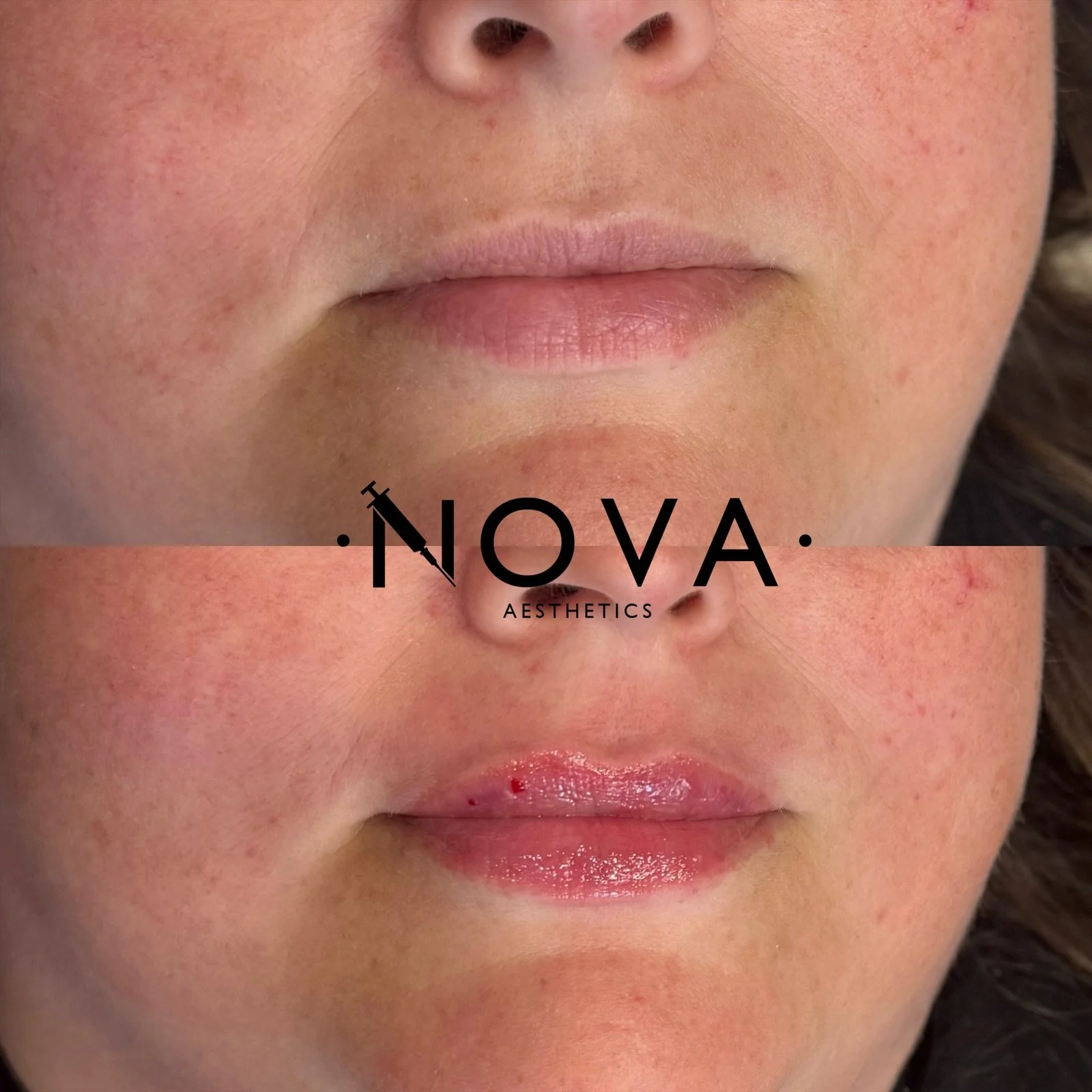 eZy Watermark_15-01-2026_02-46-53-2700pm.JPG