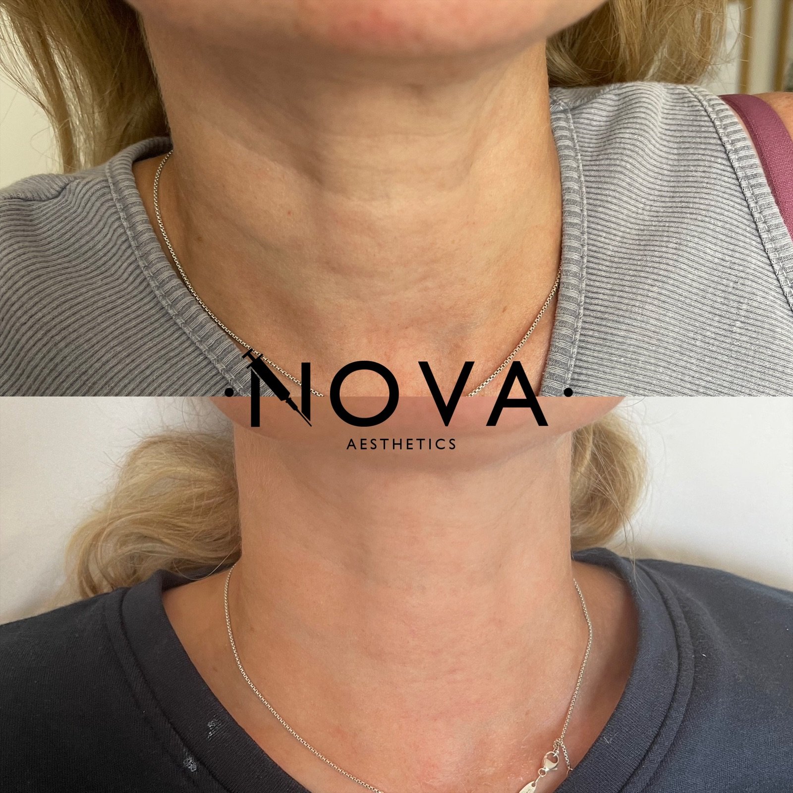 eZy Watermark_21-08-2023_08-21-43-8970pm.JPG