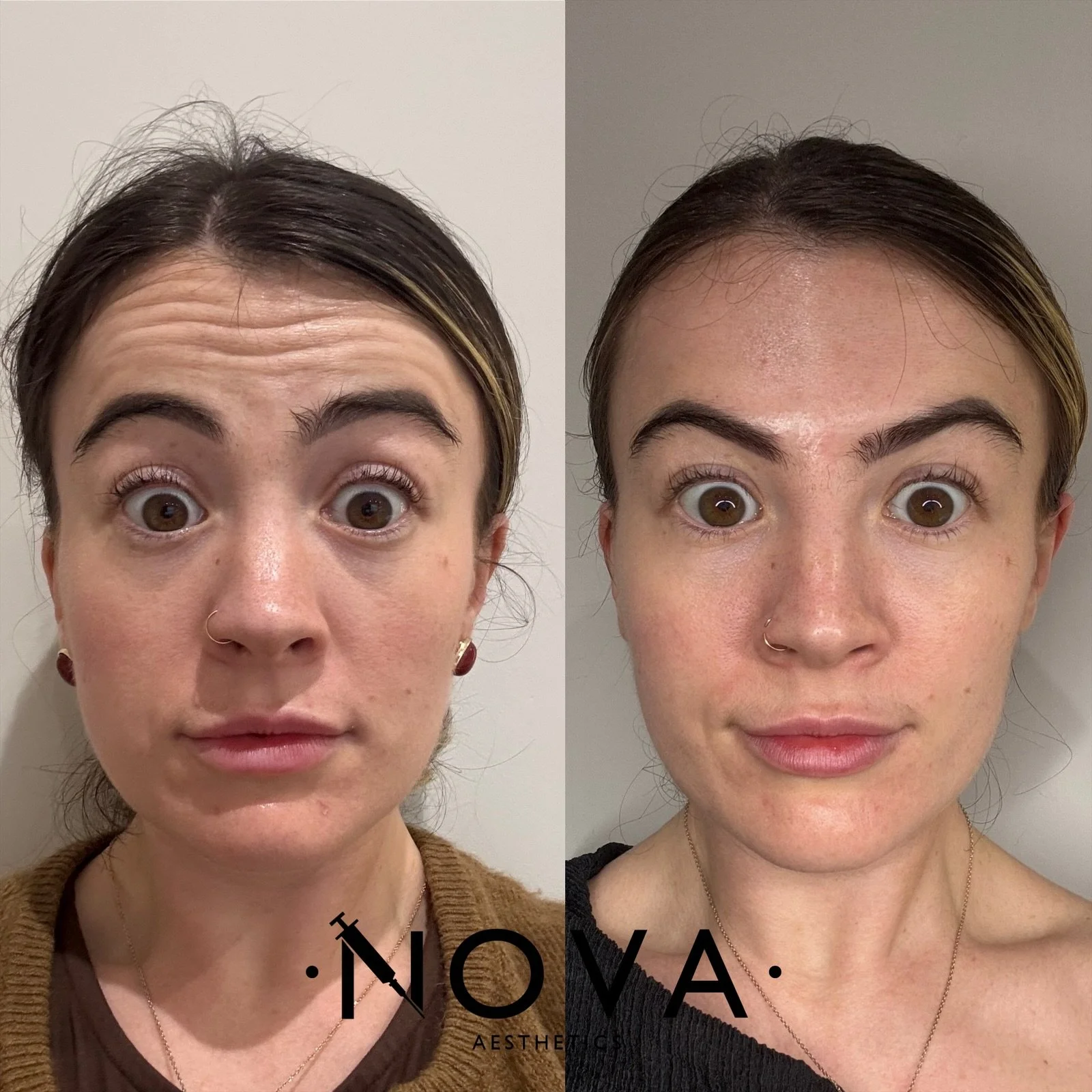 eZy Watermark_05-12-2025_12-05-49-1980pm.JPG