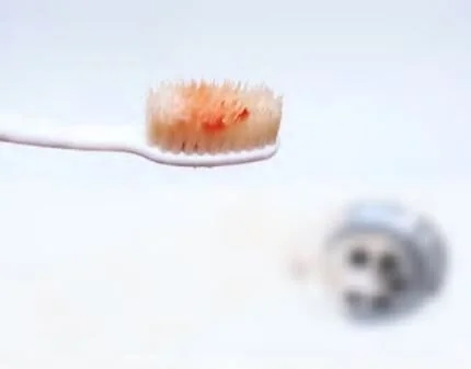 Bleeding gums 2.JPG