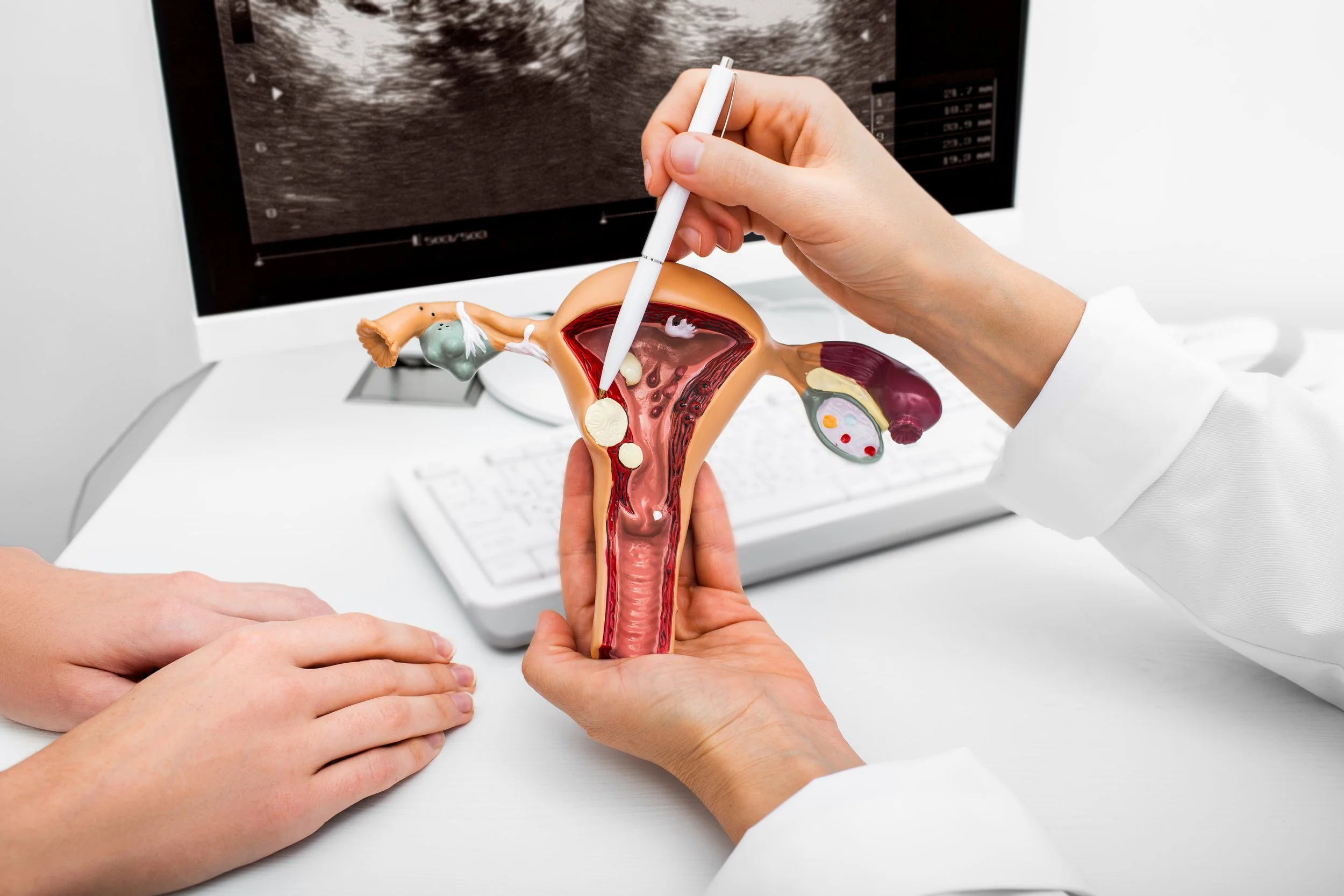 Mejorando los resultados de cirugía Oncologica en pacientes con cáncer de ovario: Protocolo ERAS