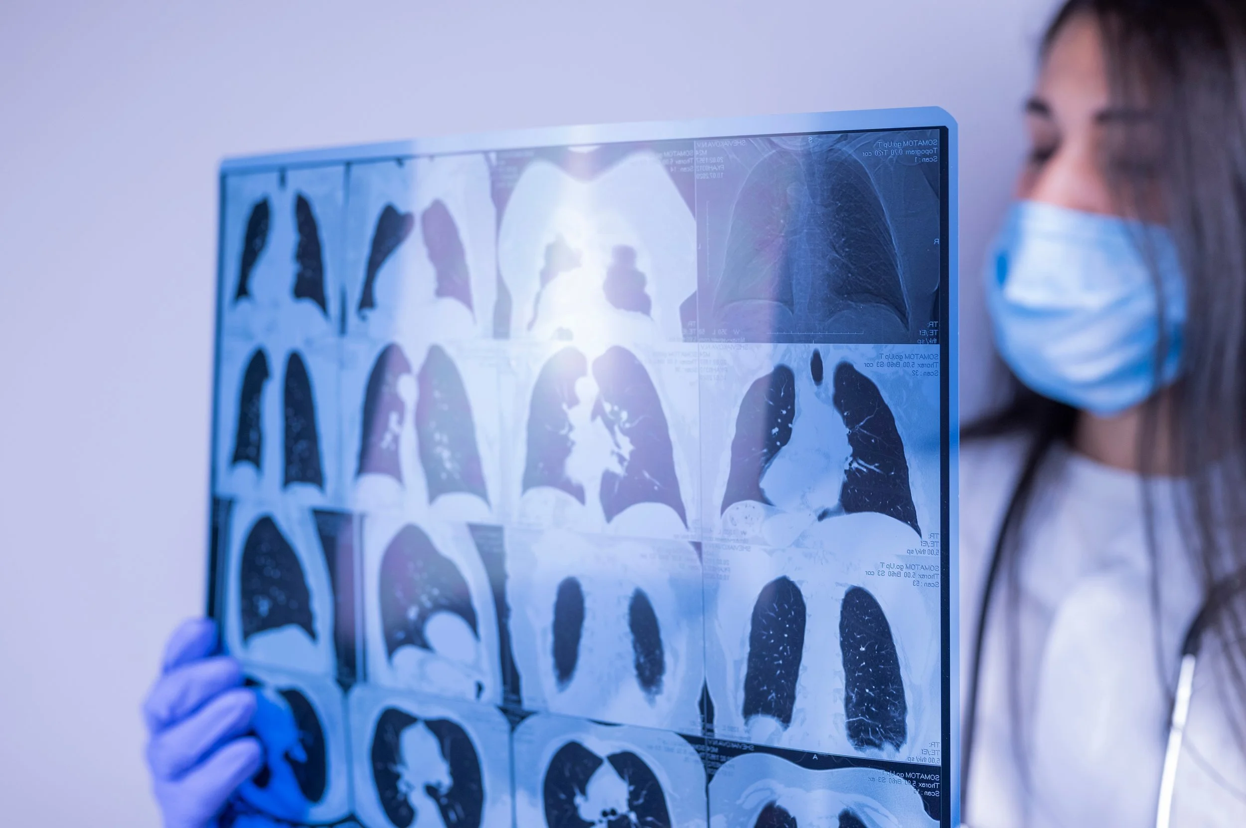Como prevenir la insuficiencia respiratoria post extubación