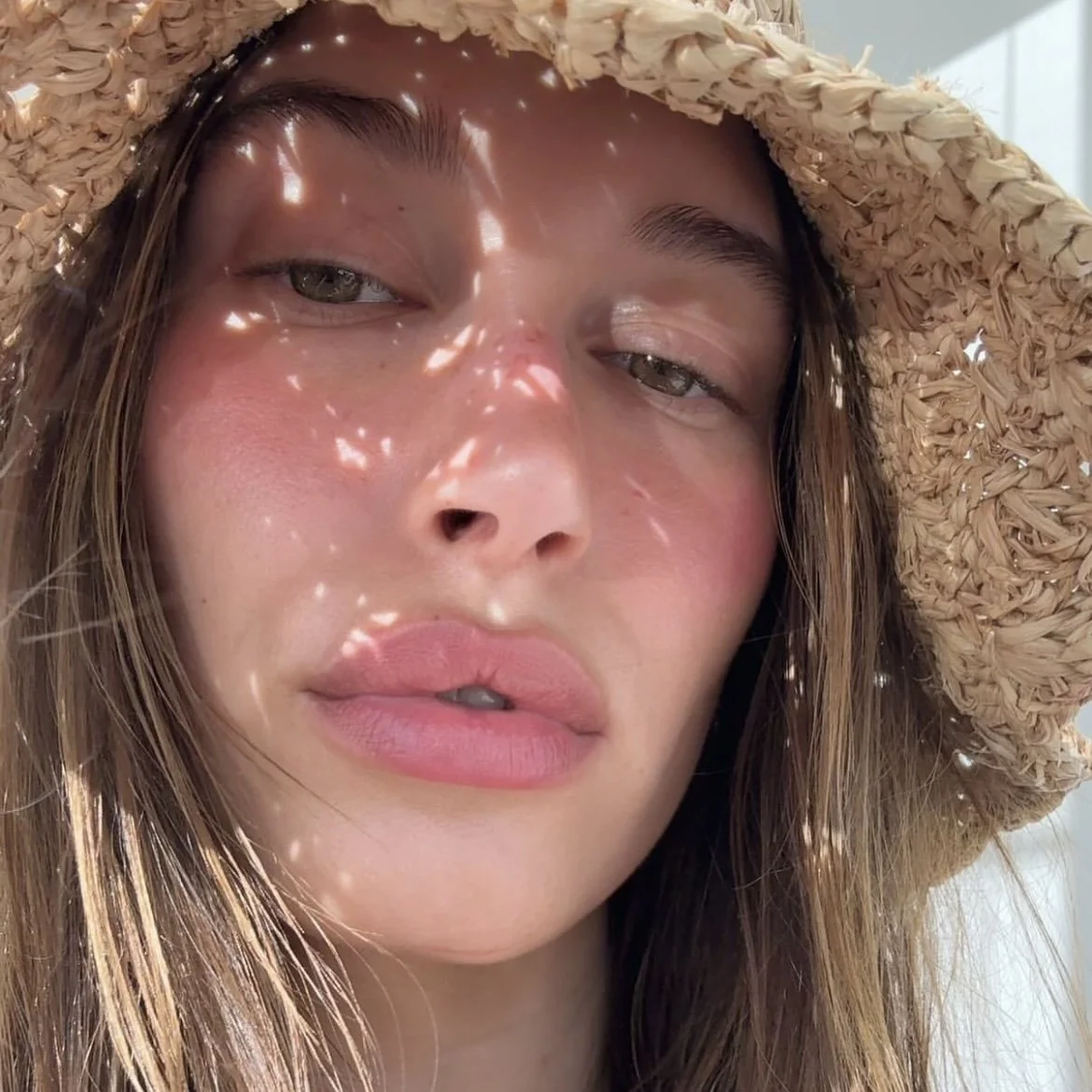 Marie Claire: What's the Difference Between HA and CaHA Fillers? Here's What You Need to Know