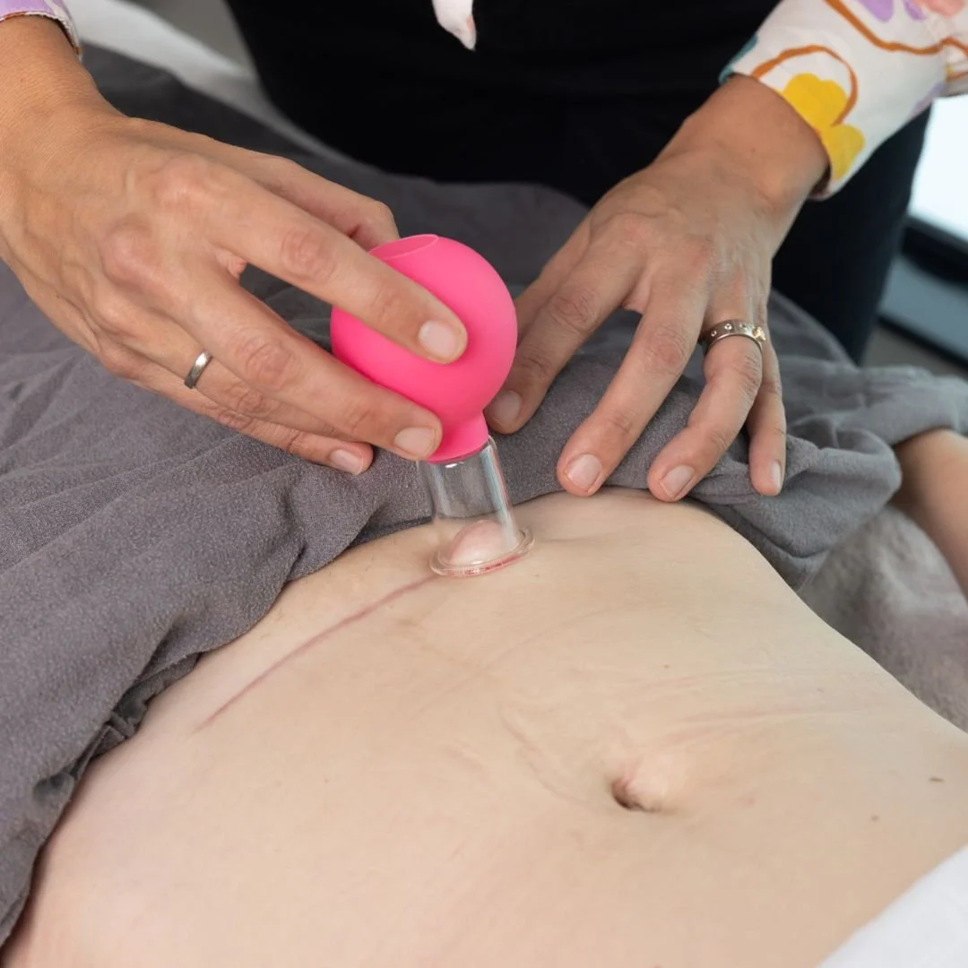 Practitioner treating scar for recovery after a Caesarean birth