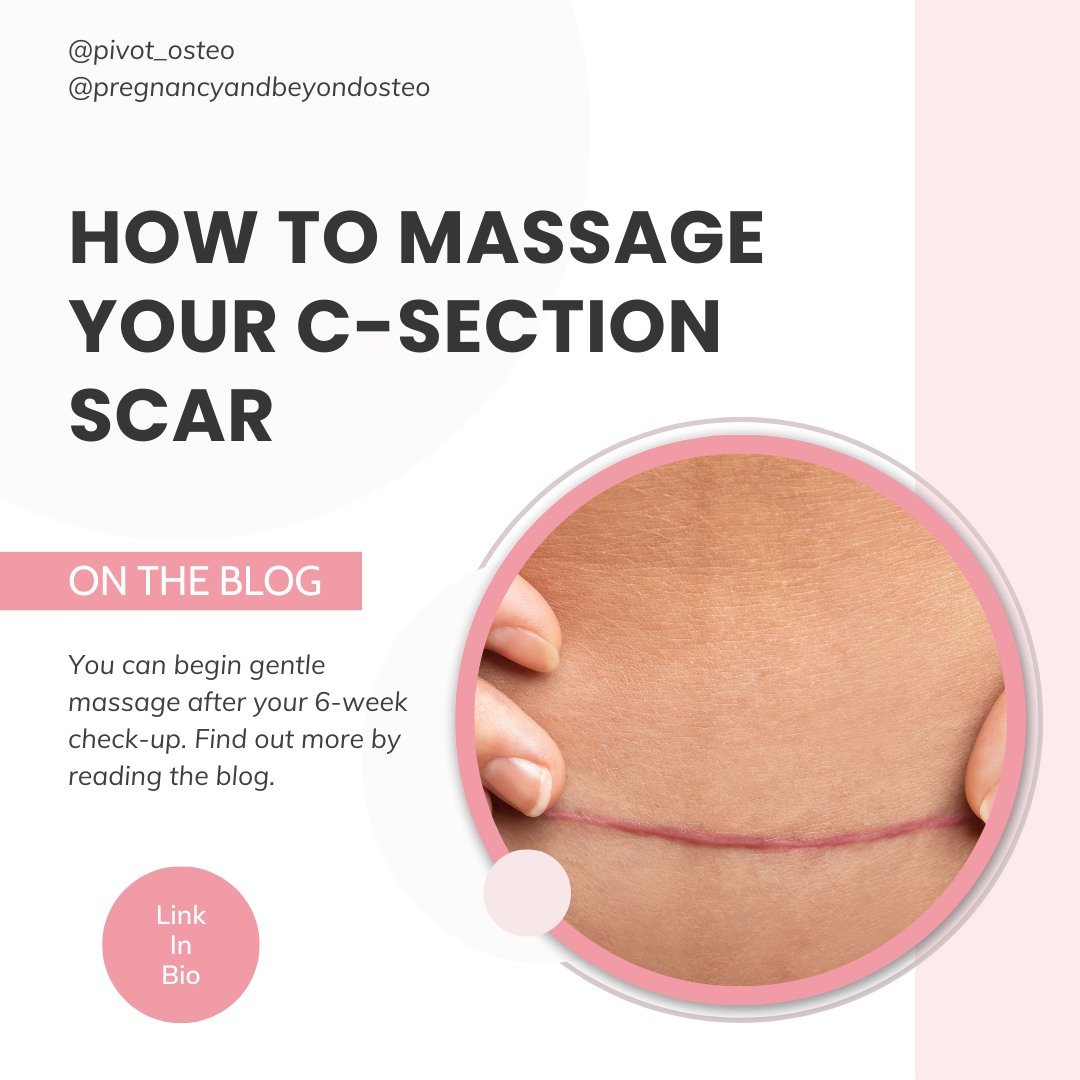 C-section scar massage can be a great way to improve the mobility and appearance of your scar. 

You can begin gentle massage after your 6-week check-up, or sooner if your health care practitioner feels it is appropriate. Initially, the scar may be q