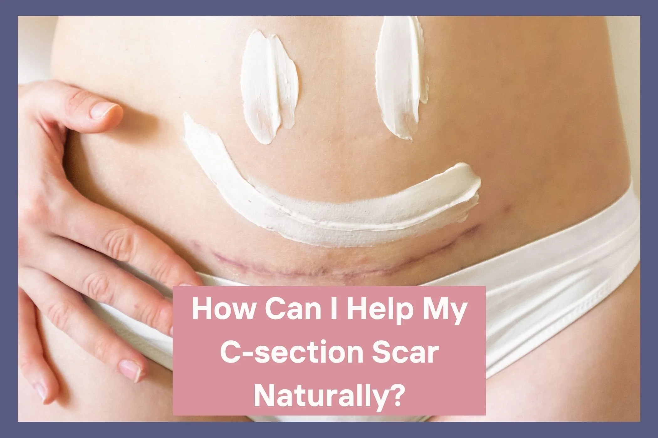 How can I help my c-section scar naturally? 