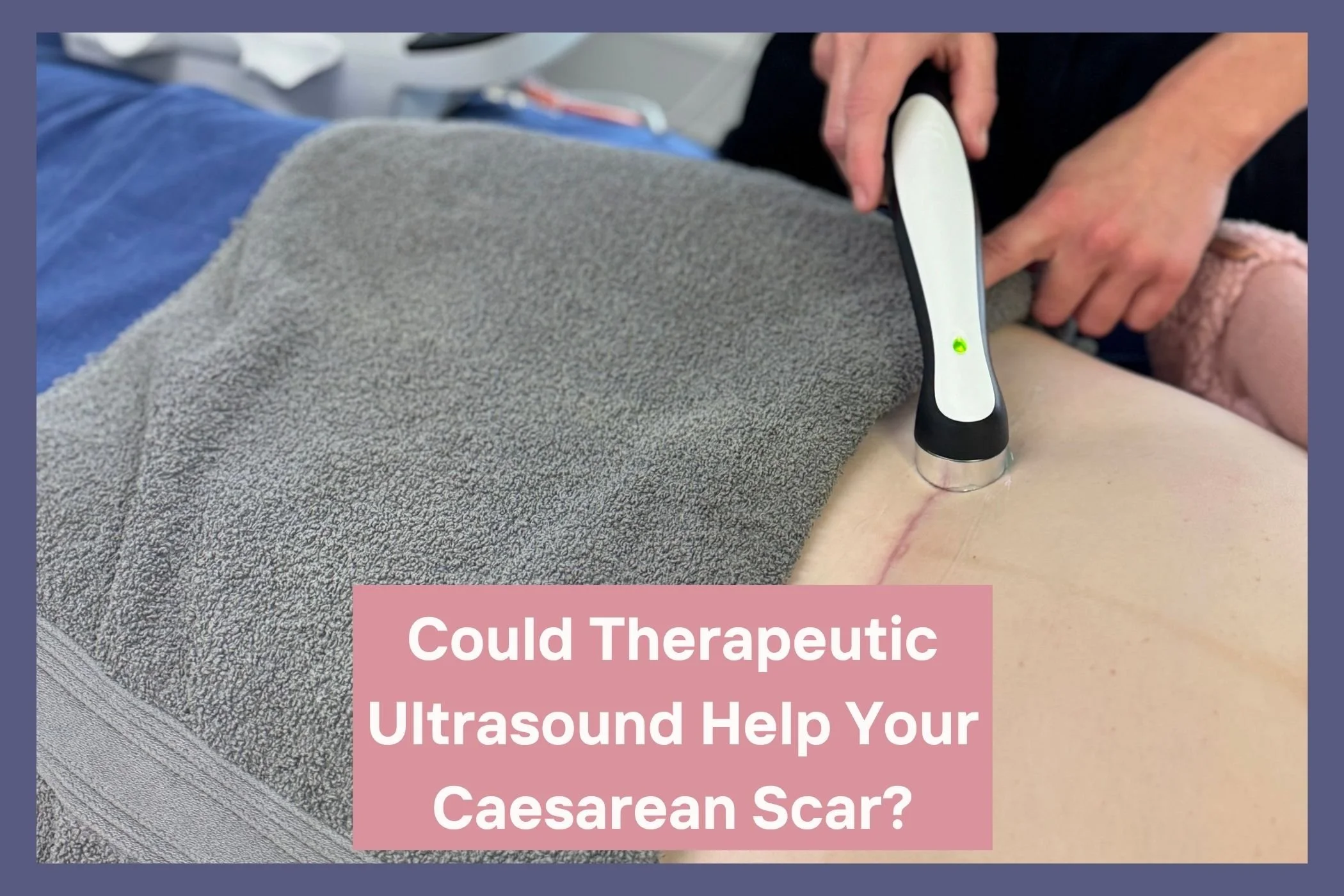 Osteopath using therapeutic ultrasound over a caesarean scar during postnatal recovery treatment