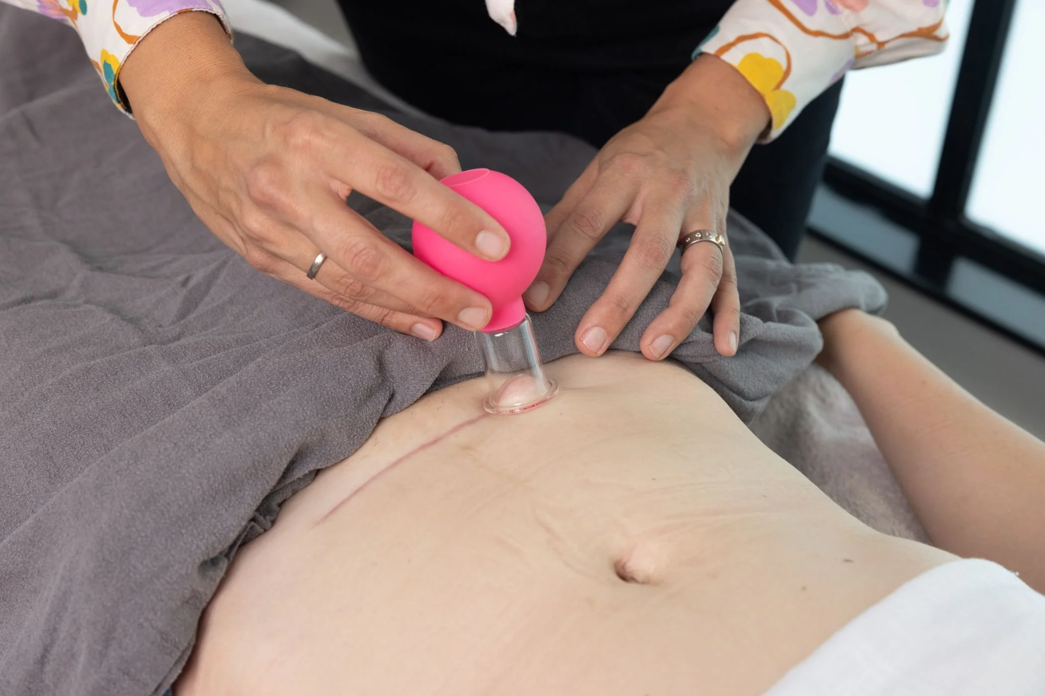 Practitioner treating scar for recovery after a Caesarean birth