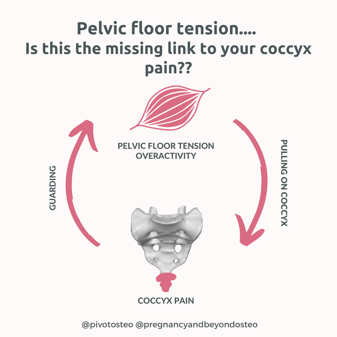 Arrows showing connection between pelvic floor tension and how they can pull on the coccyx leading to coccyx pain