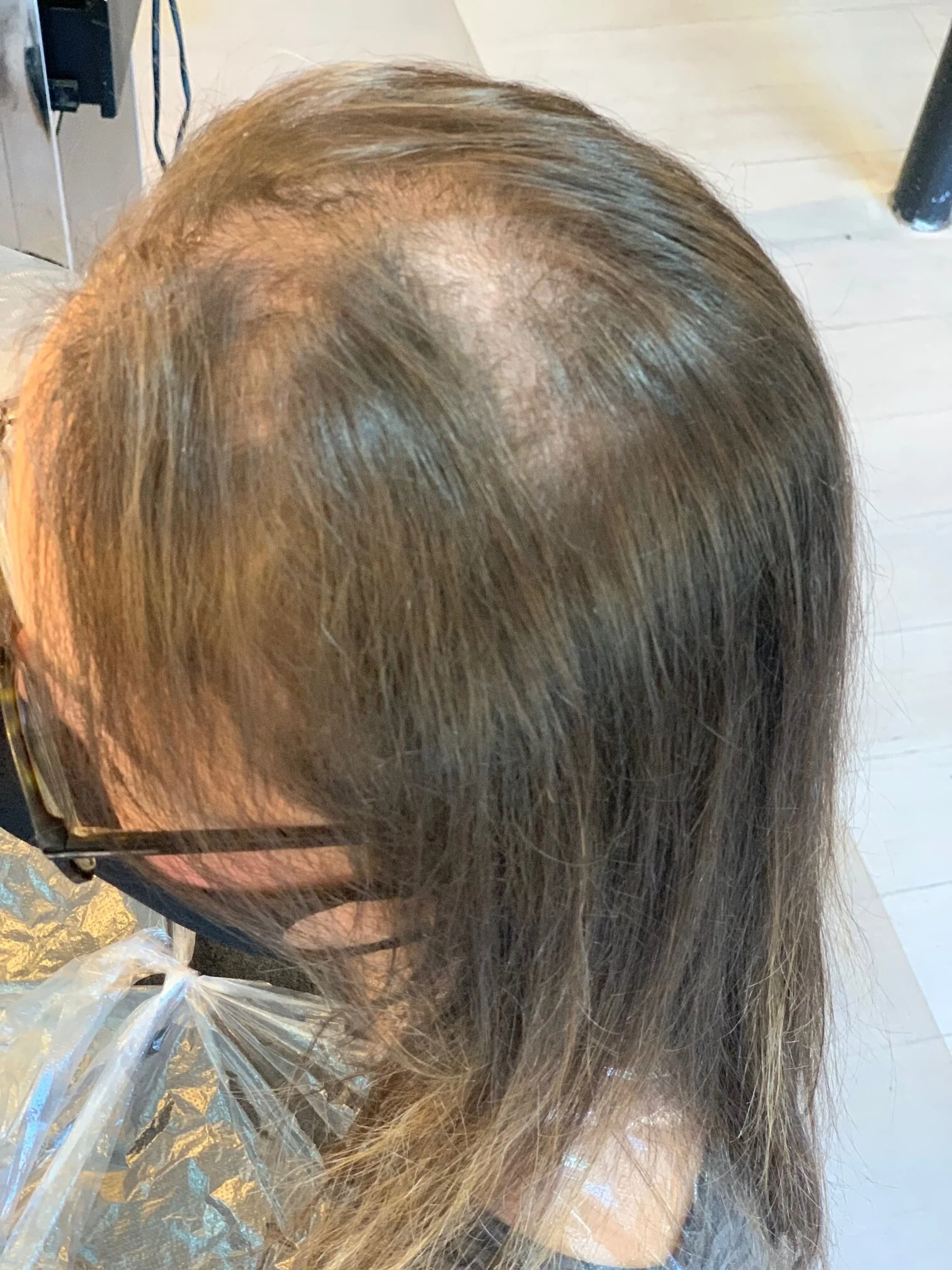 Before
