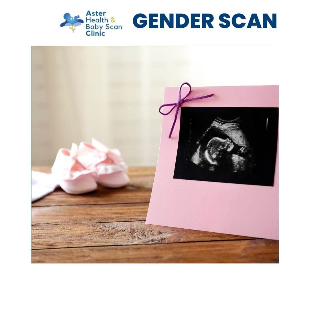 Aster-health-baby-scan-clinic-consulantant-hertfordshire-st-albans-gender-scan.jpg