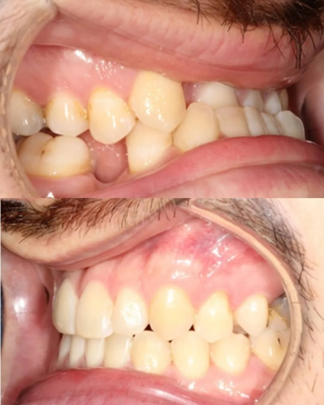 Orthodontic-Open Day-chiswell-green-st-albans-event.jpeg