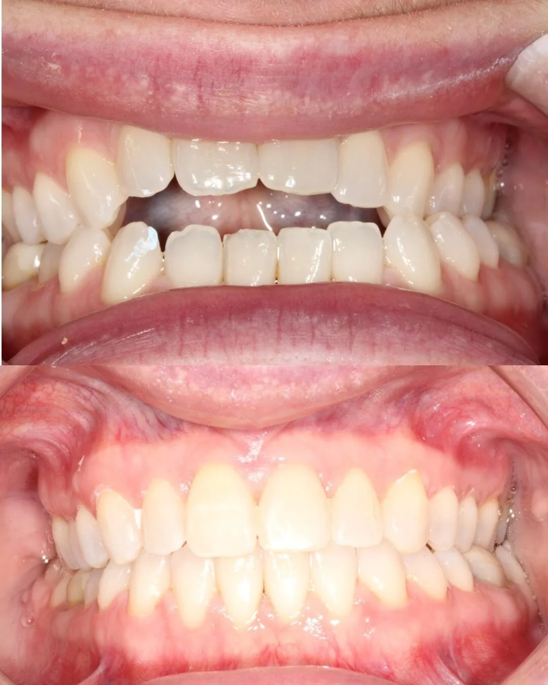 Orthodontic-Open Day-chiswell-green-st-albans.jpeg