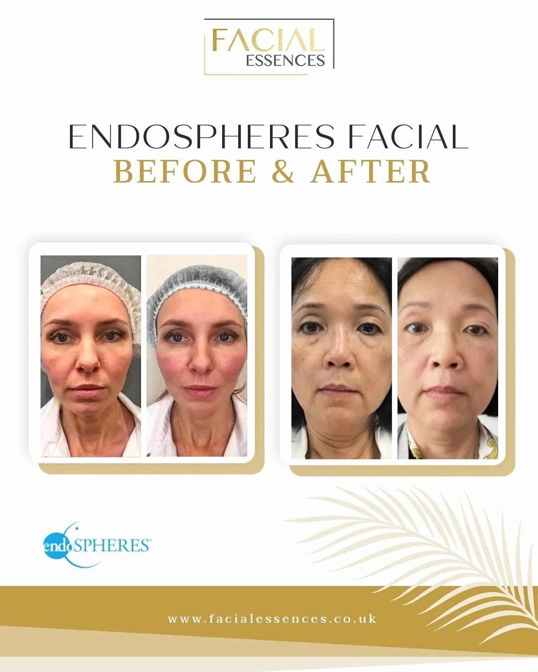 ✨ Lifted. Sculpted. Refreshed. ✨

Looking for a naturally contoured, youthful glow? Our member @facialessences has got you covered with Endospheres Therapy for the face.
🧖&zwj;♀️
This non-surgical, cutting-edge treatment is designed to sculpt and re