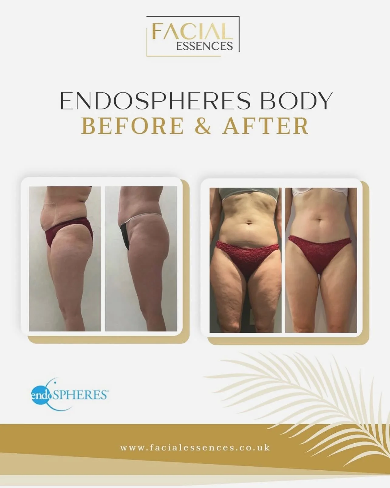 Our member @facialessences offers Endospheres Therapy, an advanced body treatment designed to refine, sculpt and revitalise the appearance of the skin.
🌟
Using innovative compressive micro-vibration technology, the treatment works to stimulate circu