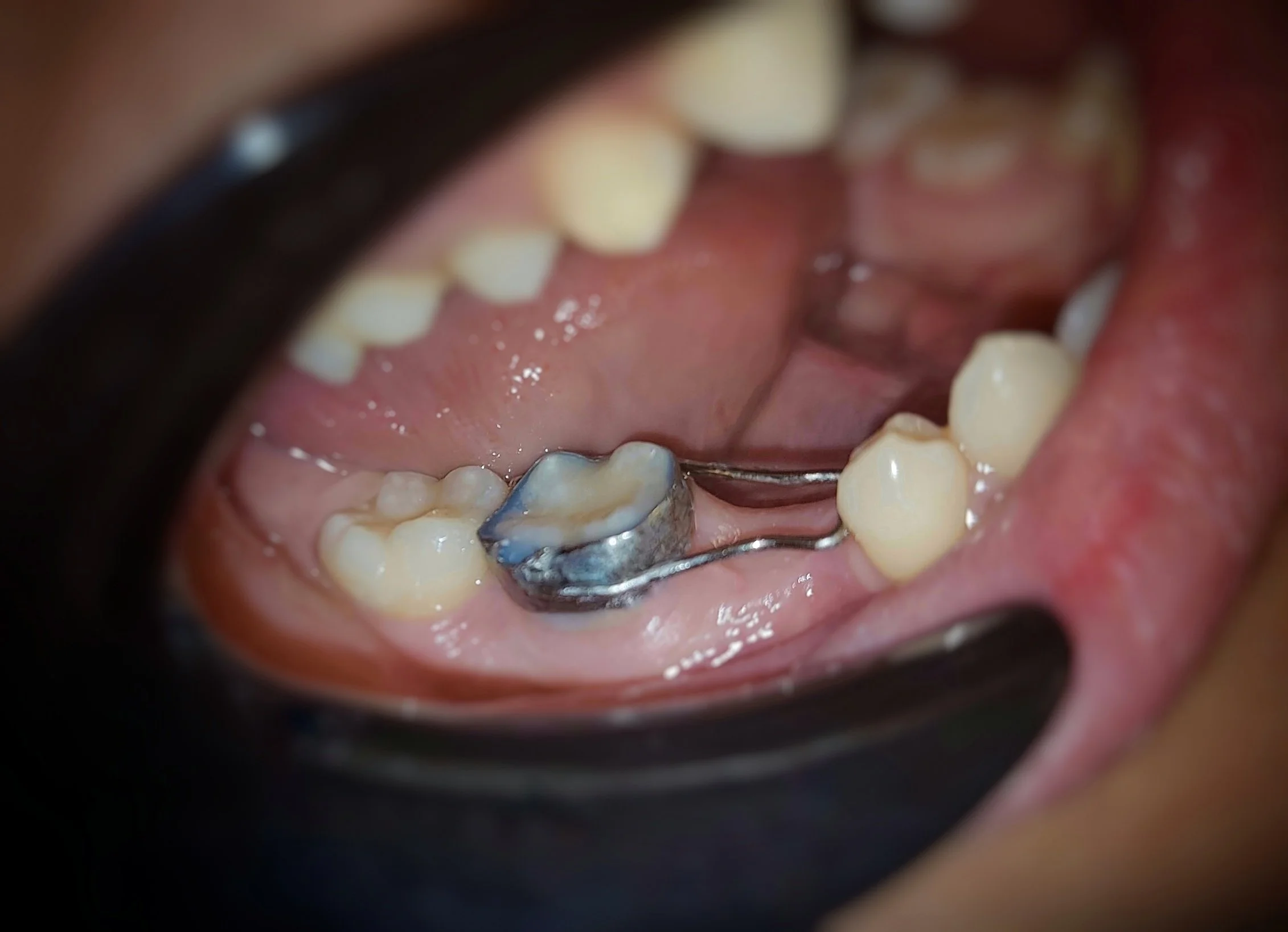 Mentinatorul de spatiu 