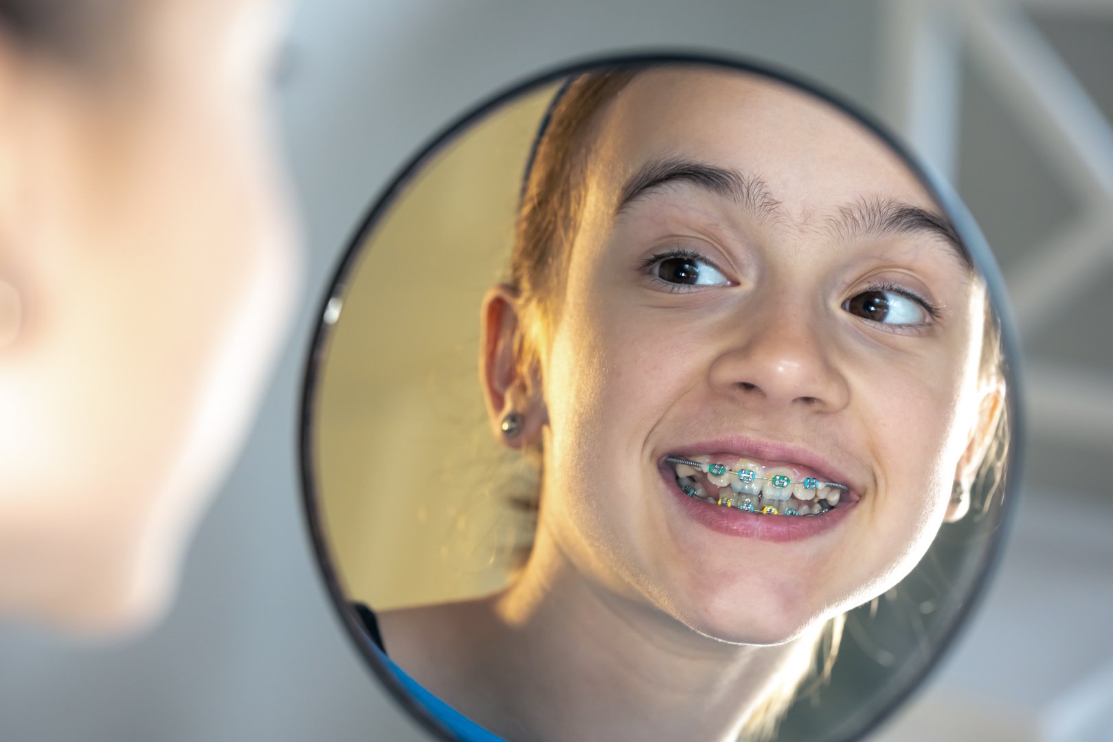 Știați că afecțiunile ortodontice &icirc;ncep &icirc;ncă din copilărie, odată cu apariția dinților definitivi?

Beneficiile tratamentului ortodontic &icirc;nceput de timpuriu sunt numeroase, iată unele dintre ele:

🔸 corectarea problemelor dentare &