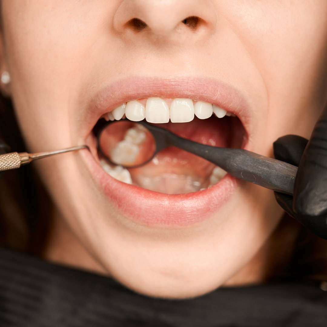 La Clinica Stomdas tratăm cu profesionalism fiecare caz. Fie că este vorba de o simplă carie, o igienizare profesională sau un tratament endodontic complex, tratăm fiecare caz cu atenție la detalii și elaborăm o structură de tratament pentru fiecare 