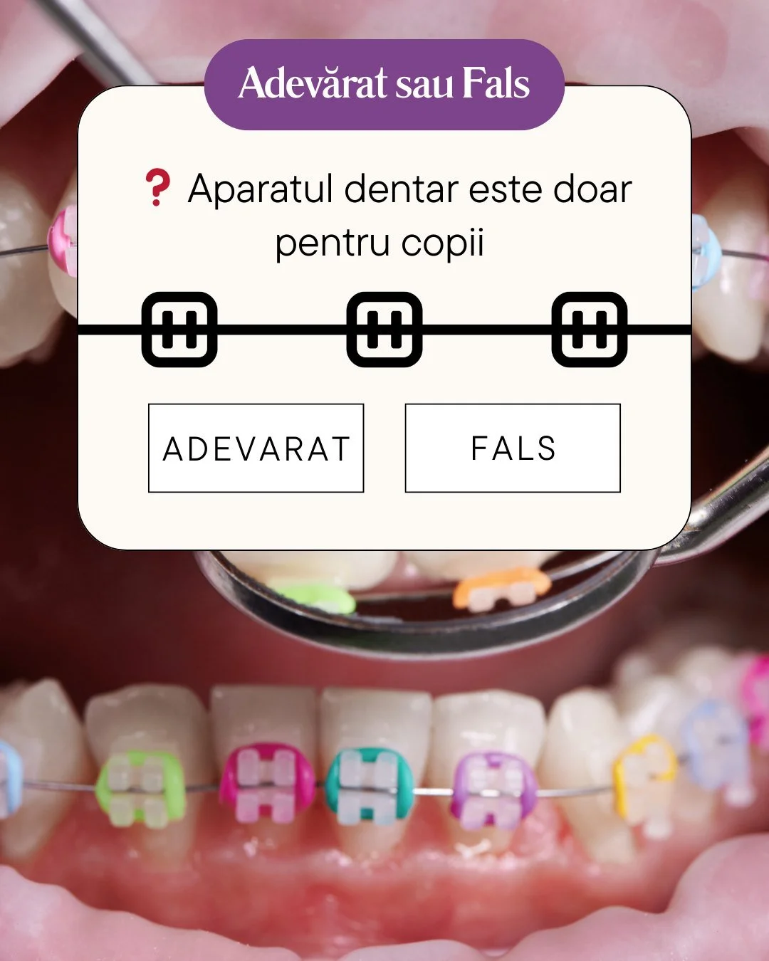 Răspuns corect: FALS ❌

Dacă ai ales varianta FALS, ai mare dreptate! Deși oasele maxilare ale copiilor sunt mai maleabile, facilit&acirc;nd anumite mișcări, nu există o limită de v&acirc;rstă pentru a obține z&acirc;mbetul la care ai visat mereu.

D