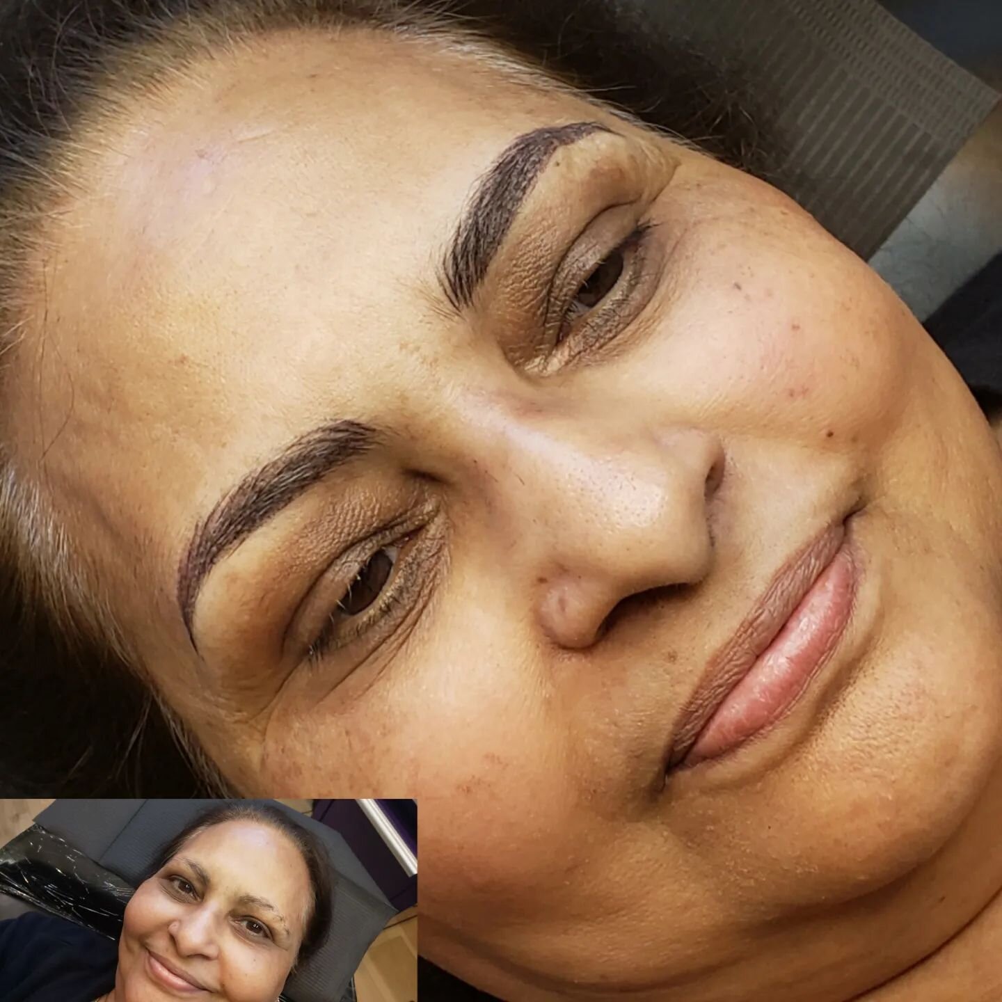 This is one of the most stunning transformations I have done recently! 🤯 This sweet lady looks YEARS younger with her new brows! 🥳 She almost looks like a different person!

 👉 Swipe to see more views 👉

As you can see she has sparse, uneven hair